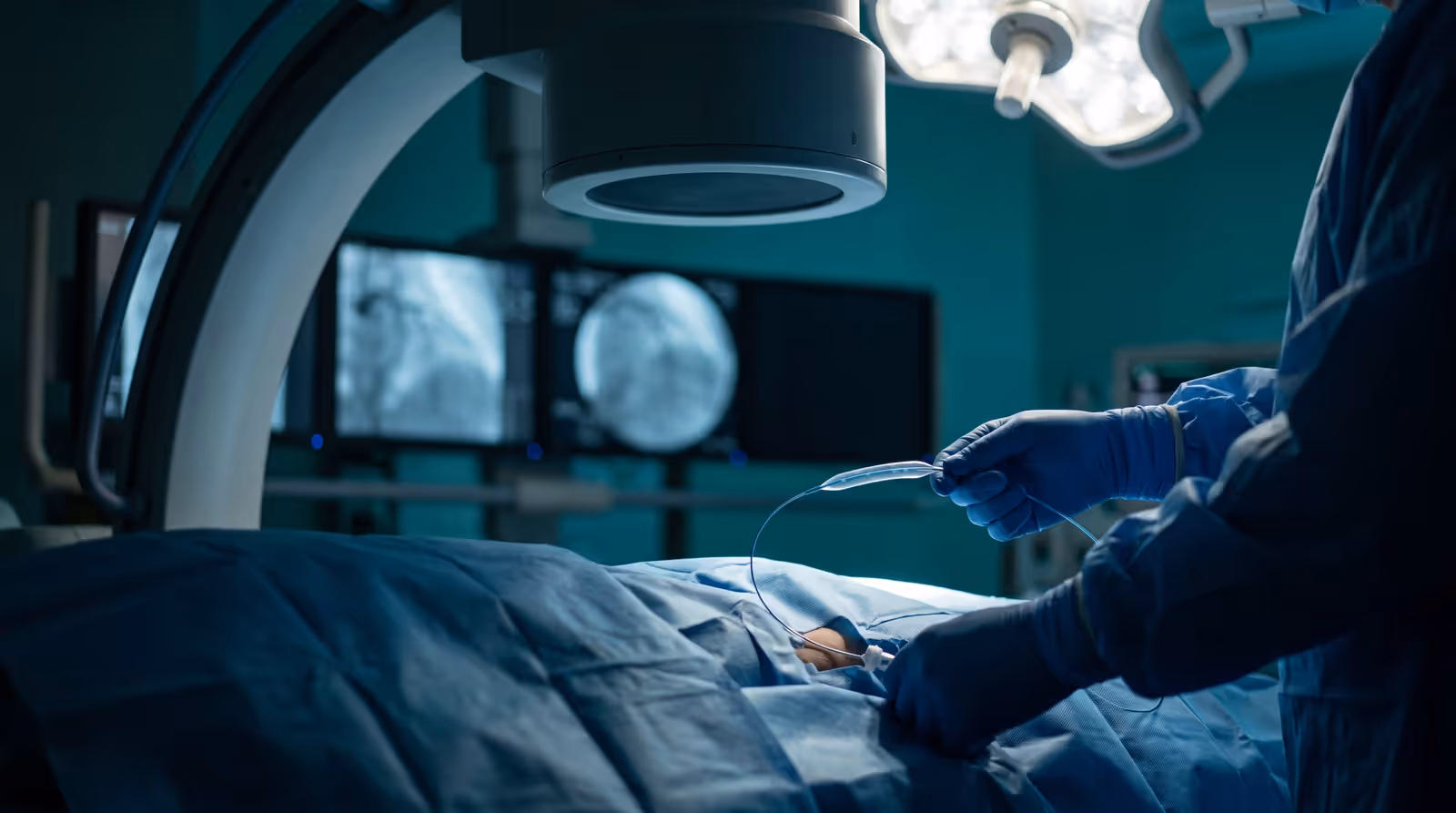 Gloved hands advancing a catheter over a guidewire in an angiography suite, imaging monitors behind